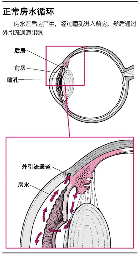 正常房水循環(huán)。