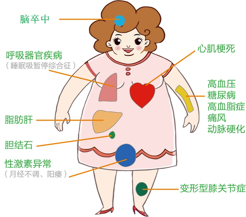 肥胖易引發(fā)的疾病。